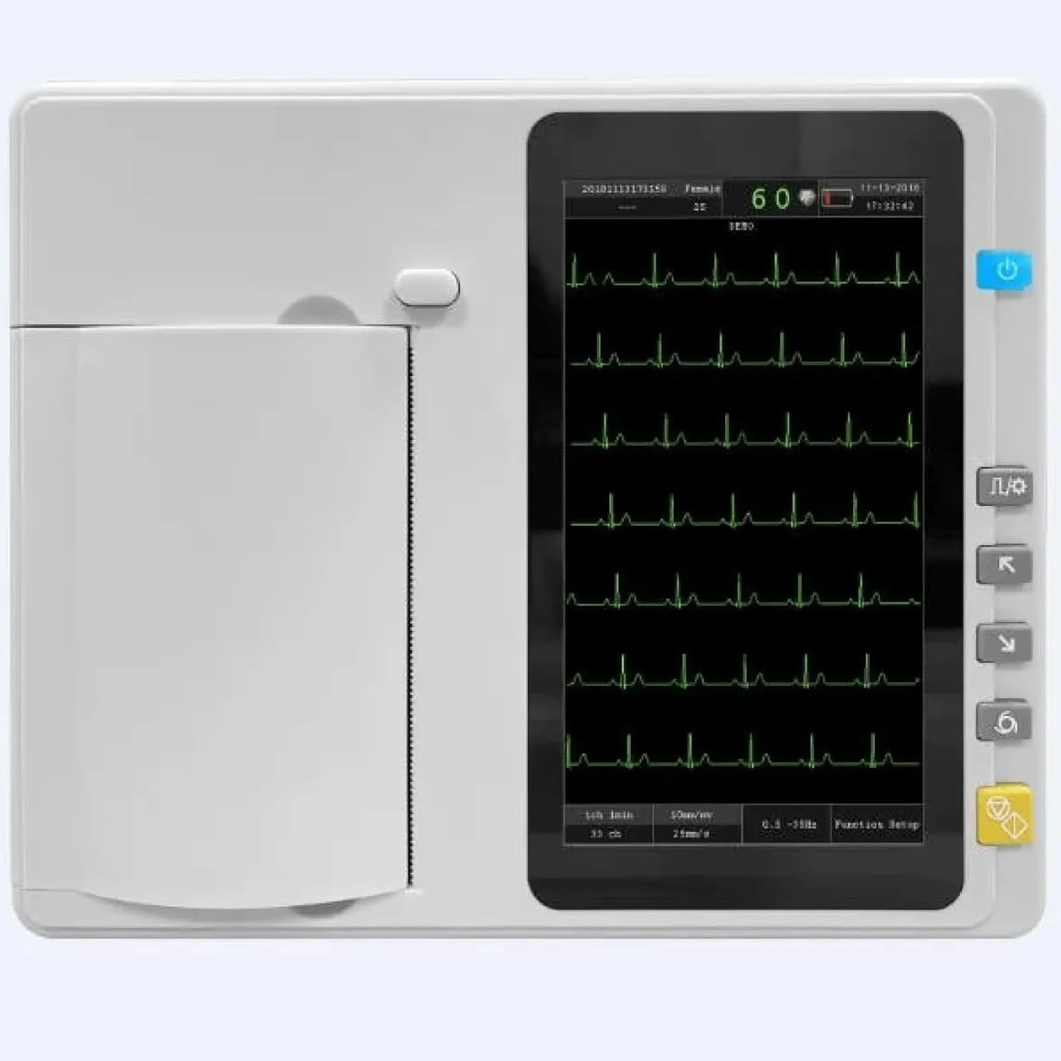 ECG601 6 Channel ECG Machine | 12 Lead Electrocardiograph with Touchscreen & Printer | Automatic Interpretation | Portable ECG for Clinics & Hospitals | Hanscure
