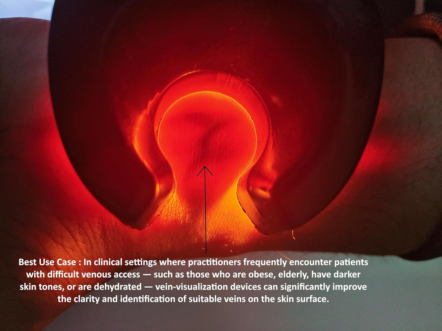 Portable Infrared Vein Finder for Adults & Children